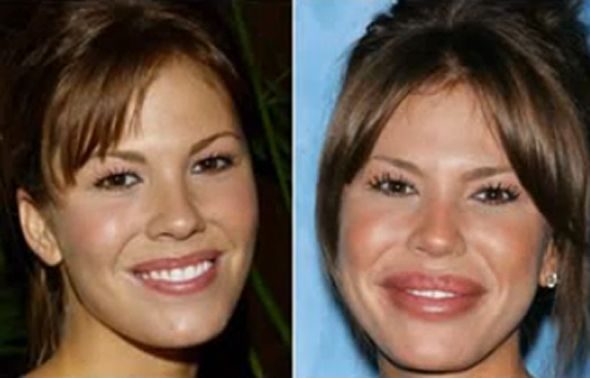 Before and After Pictures of Nikki Cox's Botched Plastic Surgery with Breast Implants and Botox